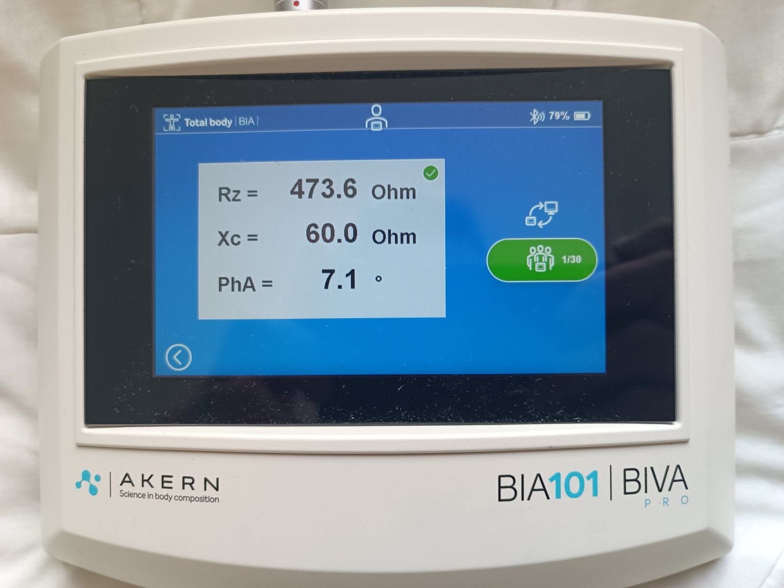 Misurazione professionale di bioimpedenziometria con elettrodi su mano e piede